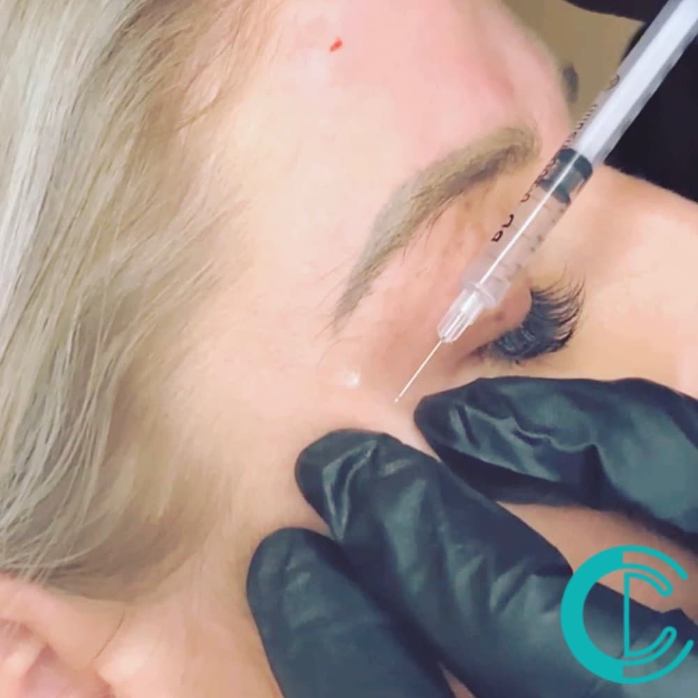 Injectables theory and simulation