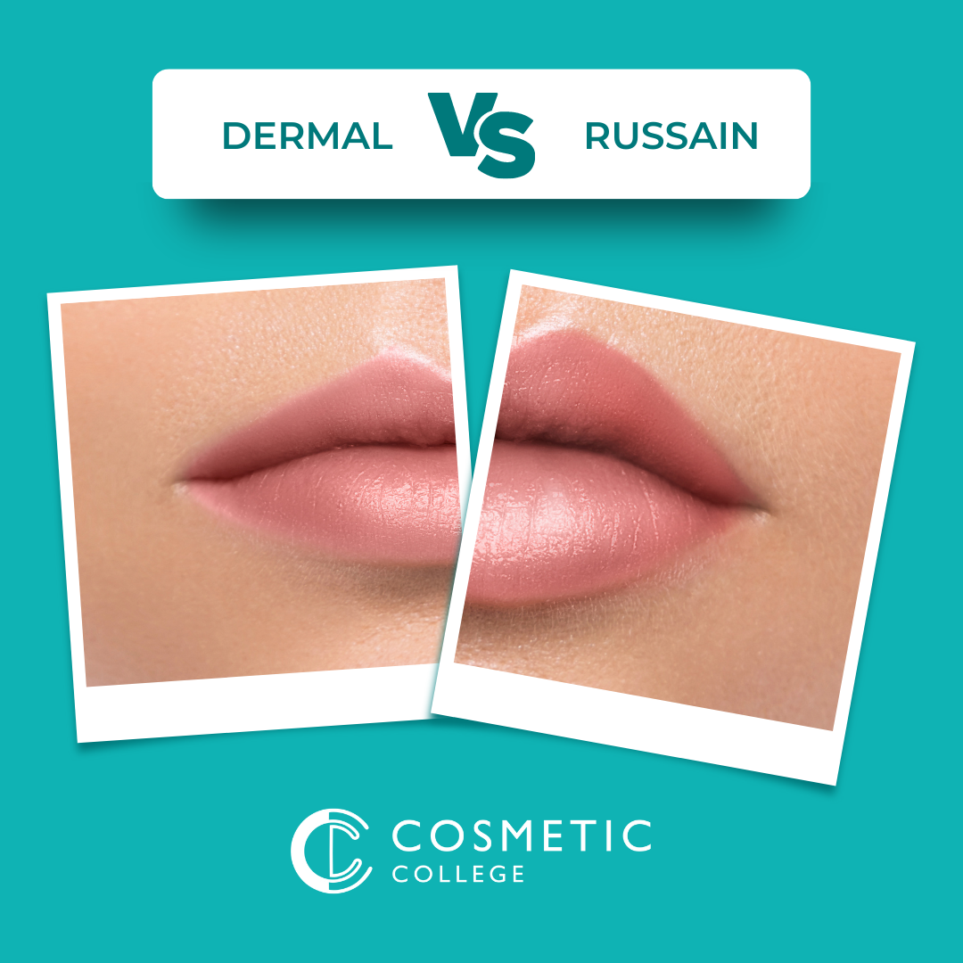 Dermal Filler Lips Vs Russian Lips Which Technique Should You Train In And Whats Best For 
