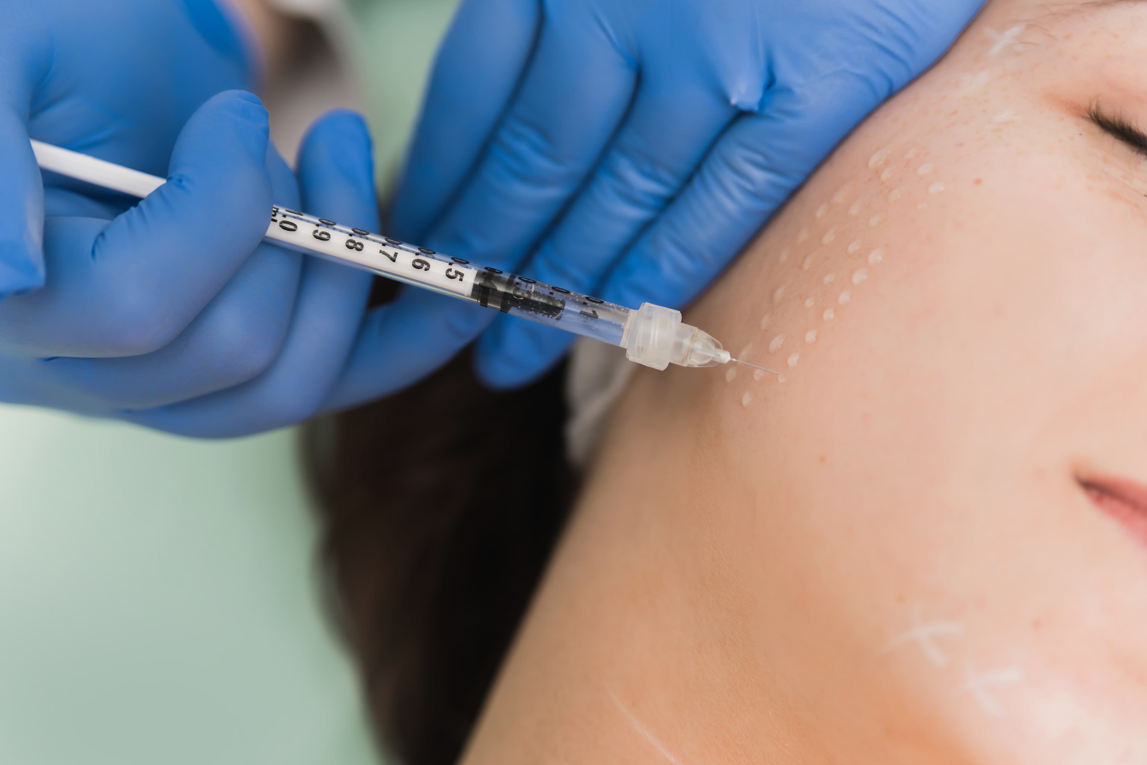 VTCT Level 6 Mesotherapy